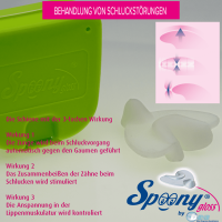 Spoony Gloss Mundschiene